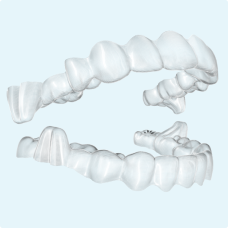 Clear aligners featuring precision wings for Class 2 overbite correction at Align Choice Orthodontics in Everett, WA.