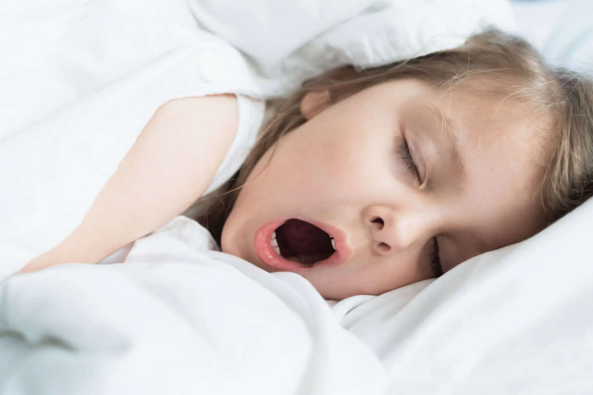2025 kids Snoring Oral sleep appliances Mill Creek
