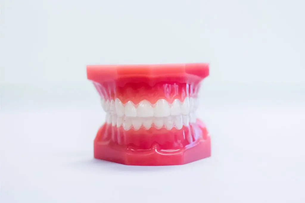 braces everett wa