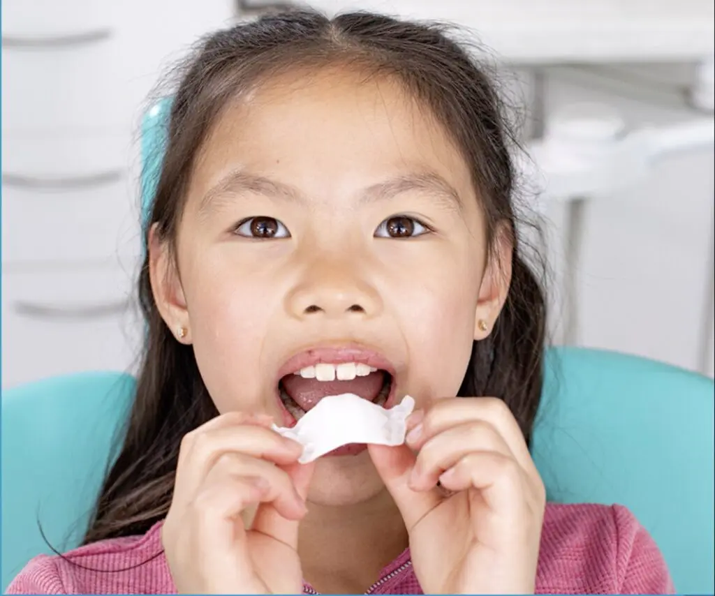Invisalign Palatal Expander in Everett