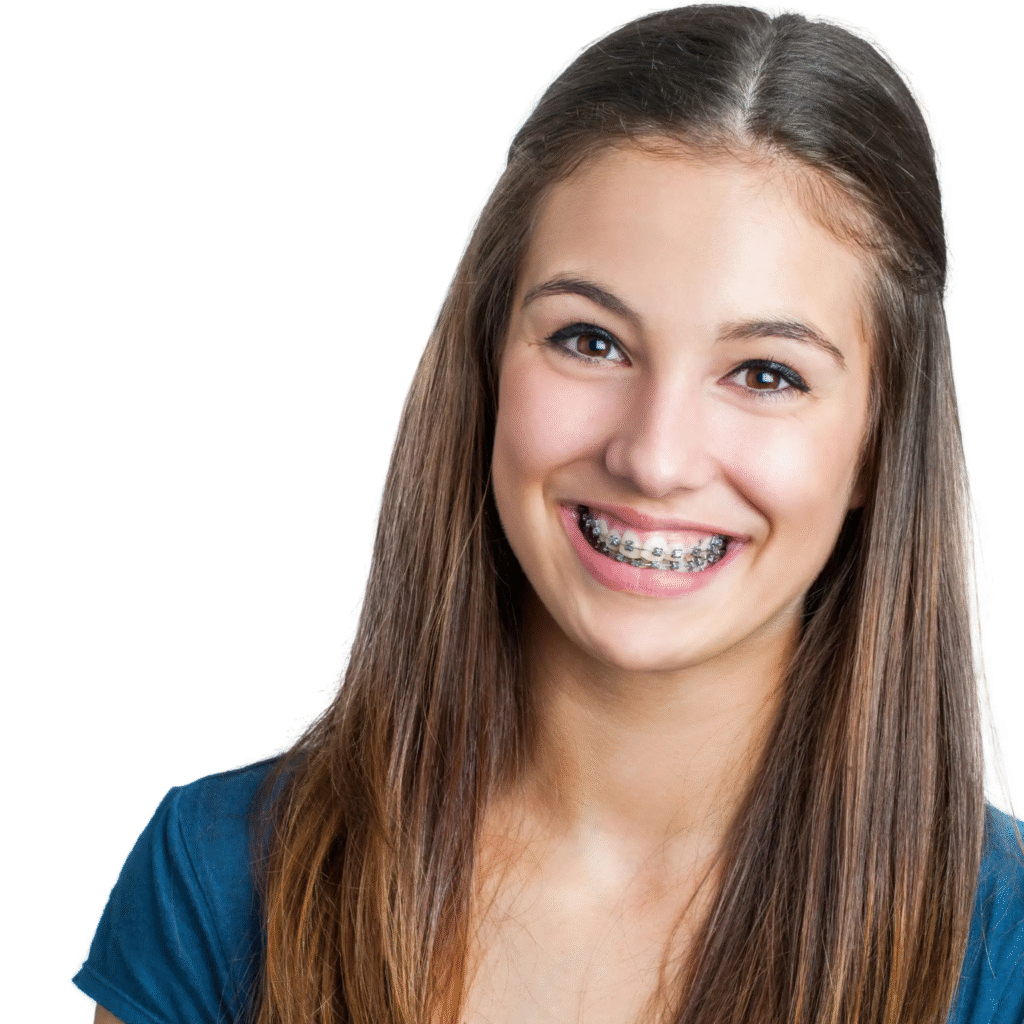 Braces 2025 Marysville WA New