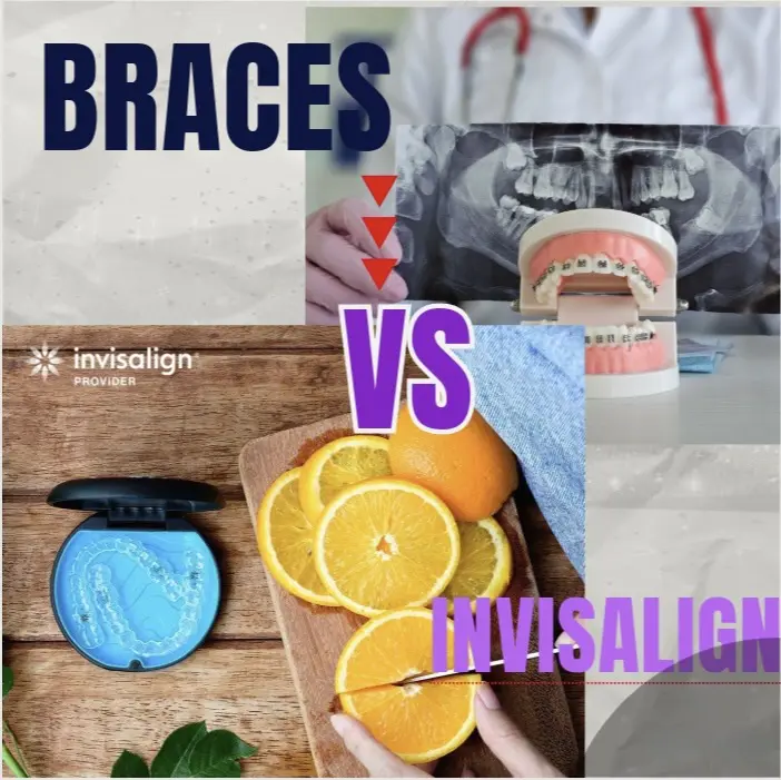 Iis invisalign as effective as metal braces everett wa