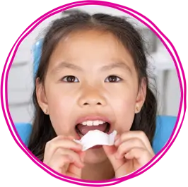 Invisalign Palatal Expander System